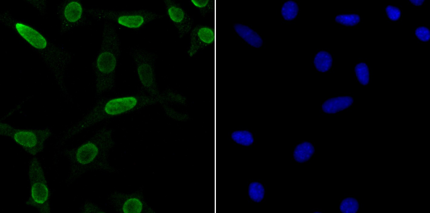 Anti-U1A Antibody (7N374)