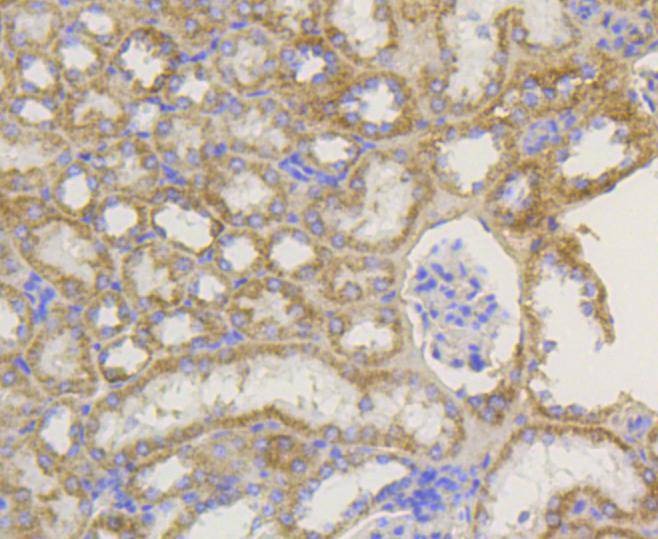 Anti-TOMM20 Antibody (6C702)