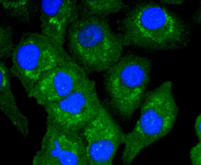Anti-TNFAIP3 Antibody (3Z618)