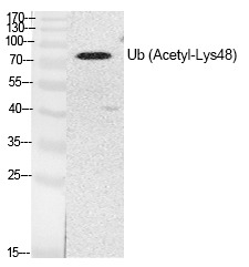 Anti-Acetyl-UBB (Lys48) Polyclonal Antibody