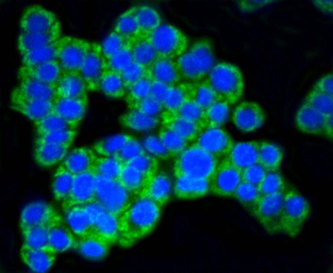 Anti-TOMM20 Antibody (6C702)