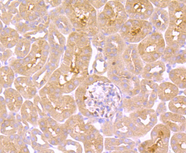 Anti-TNF RII Antibody (5O99)