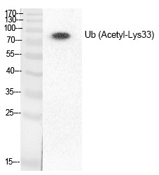 Anti-Acetyl-UBB (Lys33) Polyclonal Antibody