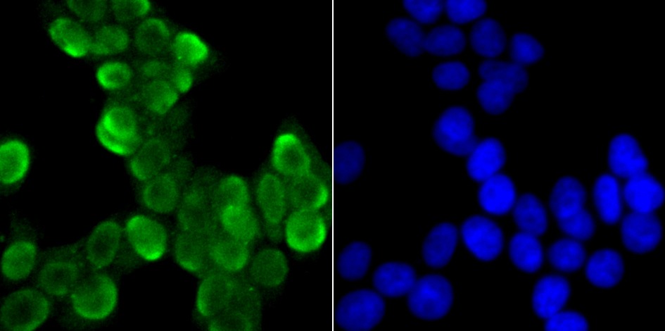 Anti-U1A Antibody (7N374)