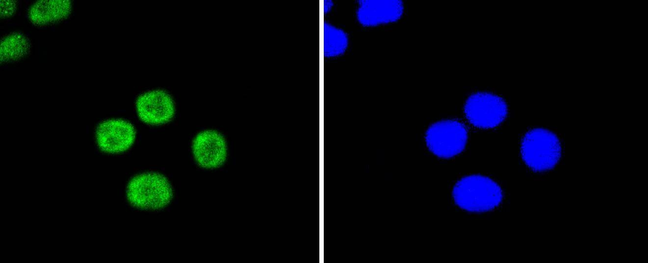 Anti-UBC9/UBE2I Antibody (6S11)