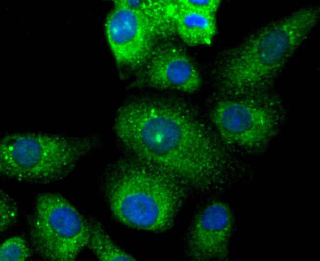 Anti-PYCARD Antibody (4C725)