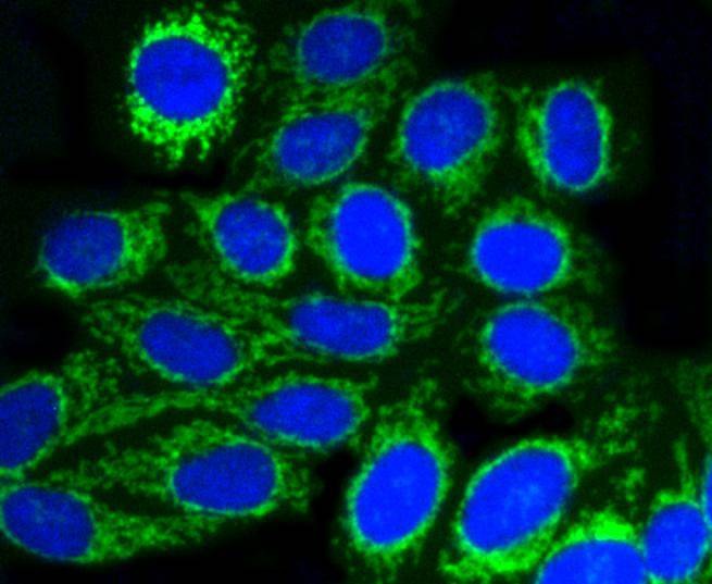 Anti-TOMM20 Antibody (6C702)