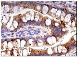 Anti-TNFR1/CD120a/TNFRSF1A Antibody (1K754)