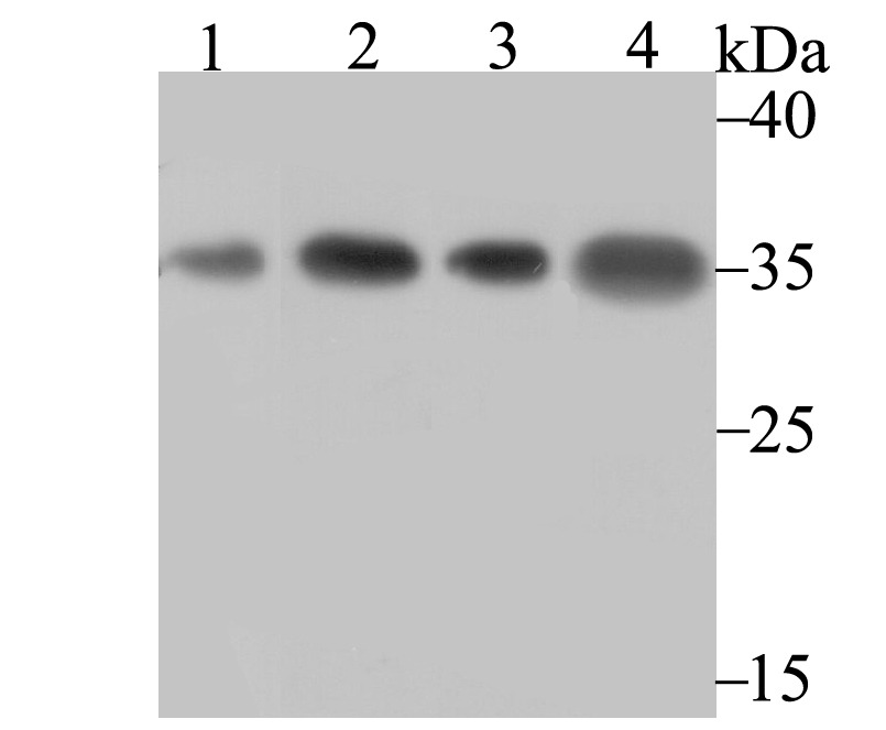 Anti-U1A Antibody (7N374)