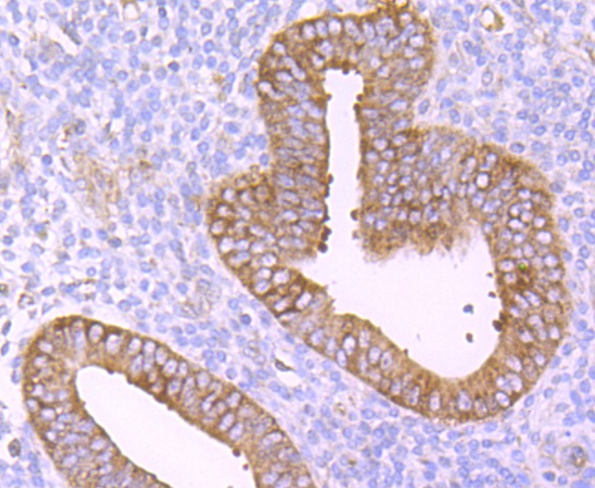 Anti-TNF RII Antibody (5O99)