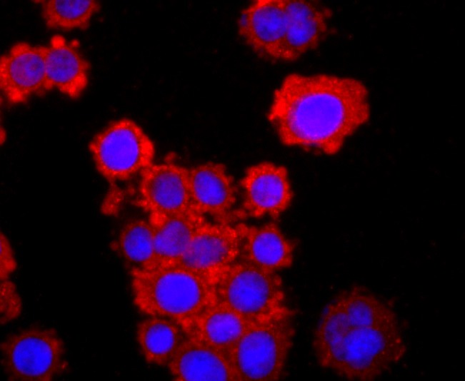 Anti-TNF RII Antibody (5O99)