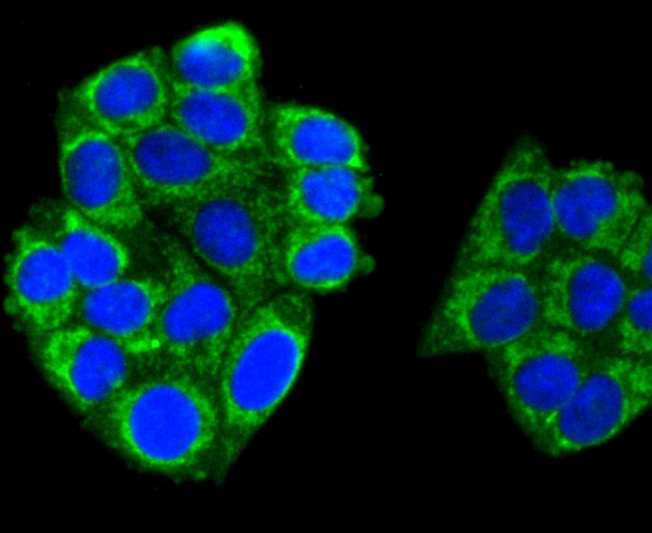 Anti-TNFAIP3 Antibody (3Z618)