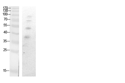 Anti-Acetyl-UBB (Lys27) Polyclonal Antibody