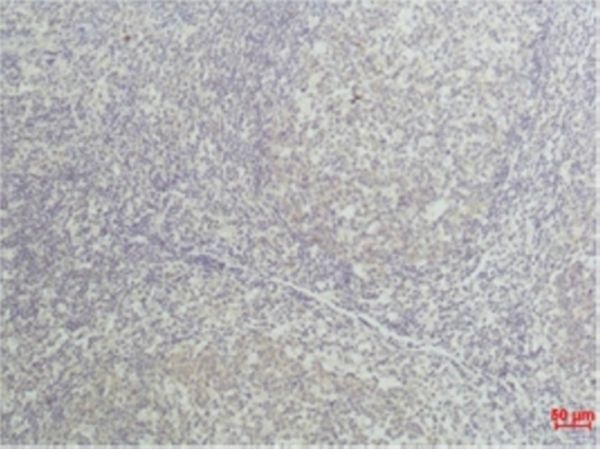 Anti-TNF alpha Antibody (4B973)