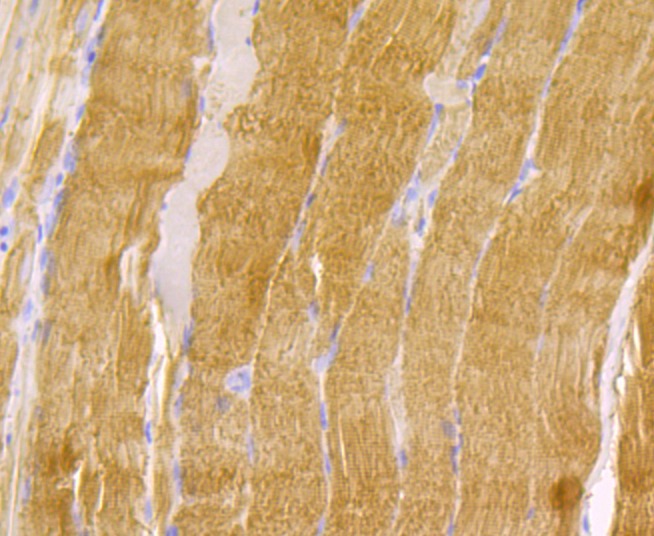 Anti-TPM1 Antibody (5W651)