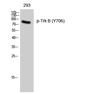 Anti-Phospho-NTRK2 (Tyr706) Polyclonal Antibody