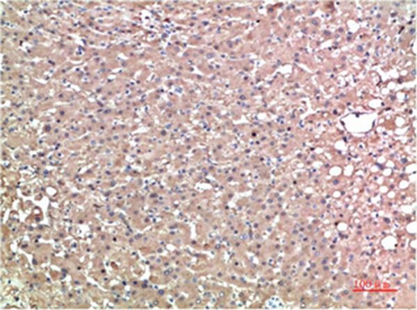 Anti-Transthyretin Antibody (3O334)