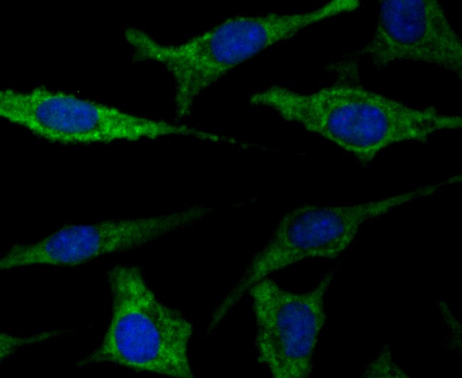 Anti-FIS1 Antibody (5I637)