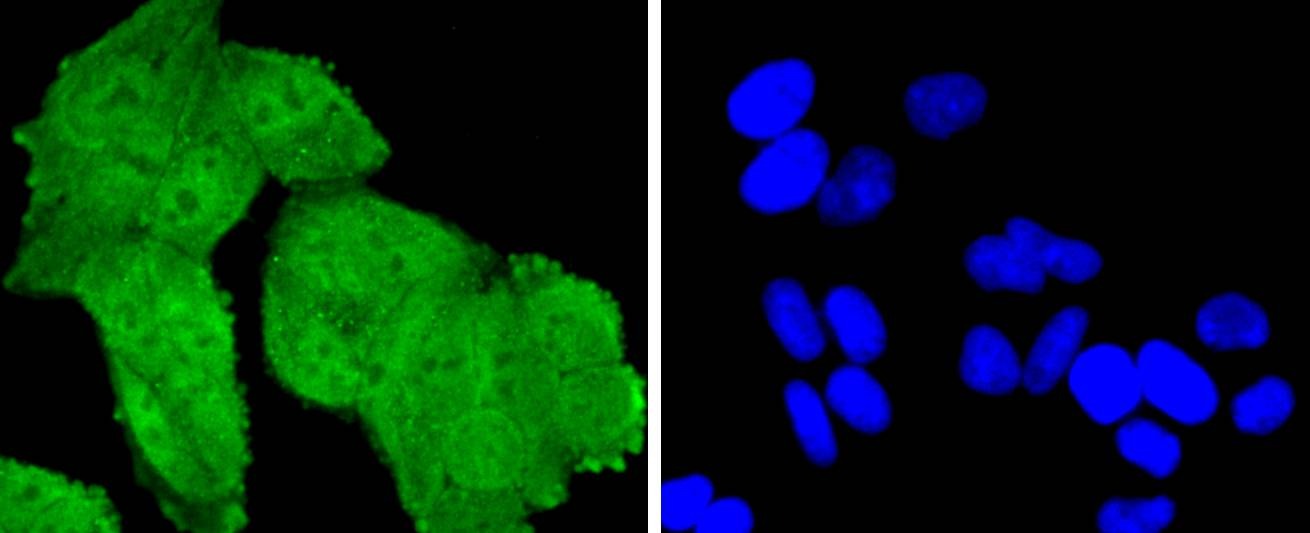 Anti-TSG101 Antibody (9U262)