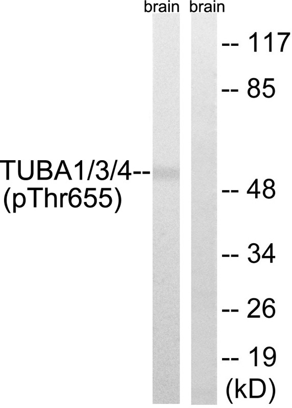 Anti-Phospho-TUBA1/3/4 (Tyr272) Polyclonal Antibody