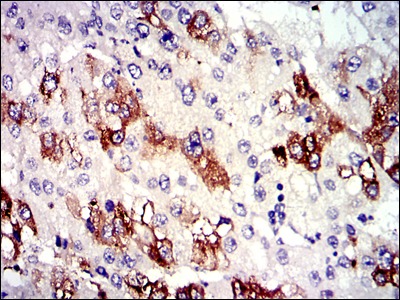 Anti-TUBA8 Antibody (8N451)