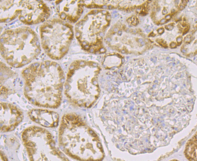 Anti-FIS1 Antibody (5I637)