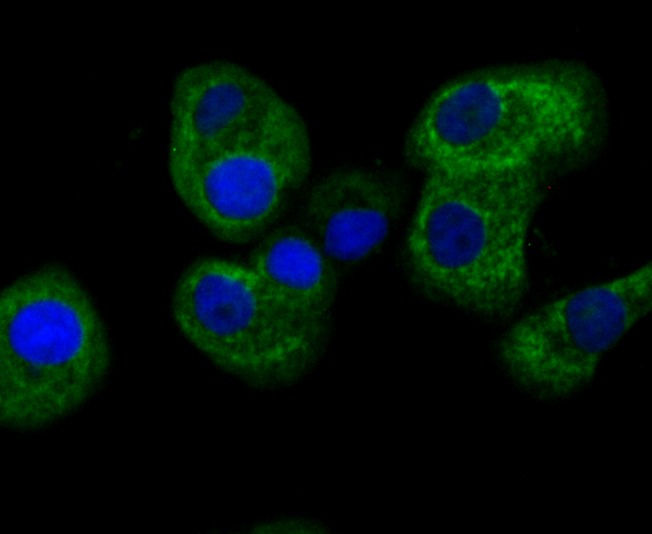 Anti-FIS1 Antibody (5I637)