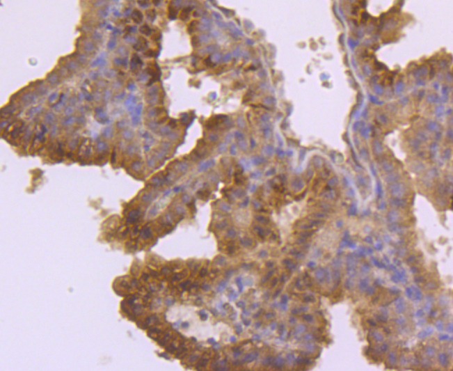 Anti-Chorionic Gonadotropin/CGA Antibody (5Q170)
