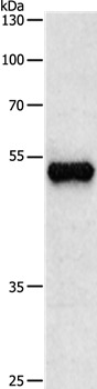 Anti-TUBB3 Polyclonal Antibody 3