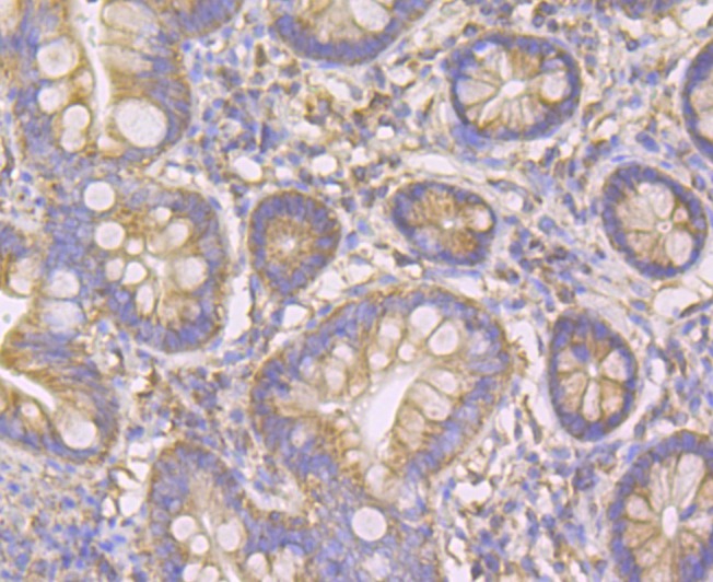 Anti-FIS1 Antibody (5I637)