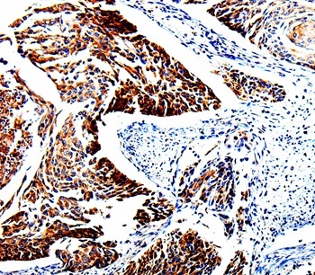 Anti-TUBB3 Polyclonal Antibody 3