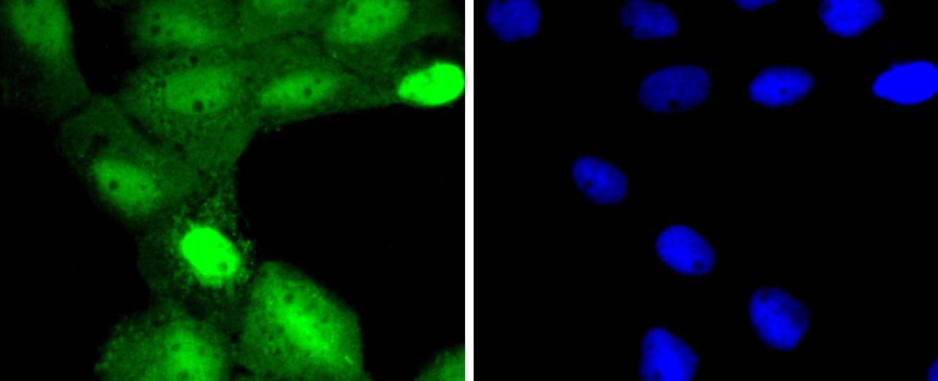 Anti-TSG101 Antibody (9U262)