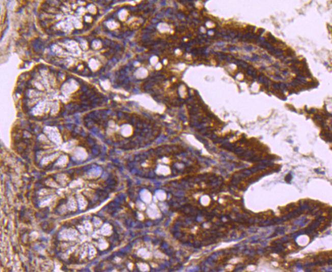Anti-TSG101 Antibody (9U262)