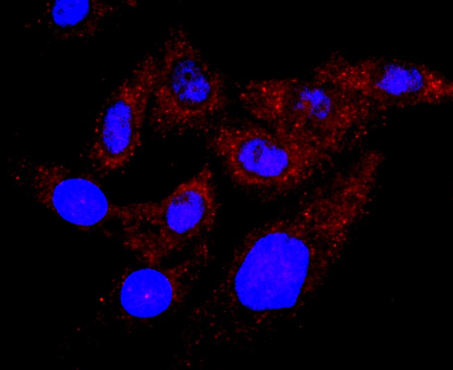 Anti-Chorionic Gonadotropin/CGA Antibody (5Q170)