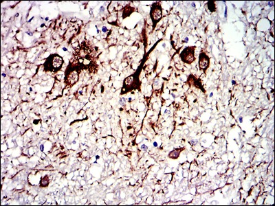 Anti-TUBA8 Antibody (8N451)