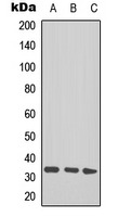 Anti-Acetyl-TAL-1/2 (Lys221, 222/Lys36, 37) Polyclonal Antibody
