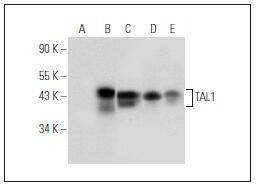 Anti-TAL-1 Antibody (7H409)