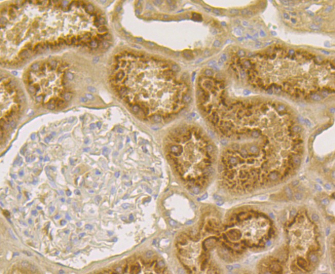 Anti-CLEC3B Antibody (6K126)