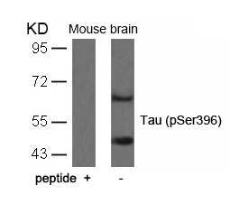 Anti-Phospho-MAPT (Ser396) Polyclonal Antibody