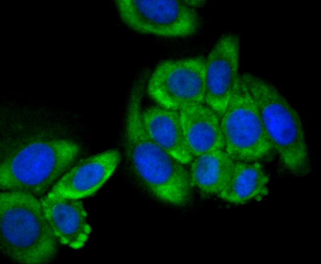 Anti-CLEC3B Antibody (6K126)