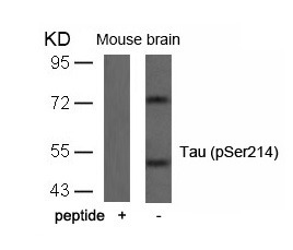 Anti-Phospho-MAPT (Ser214) Polyclonal Antibody