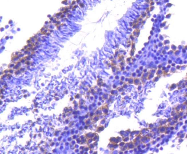 Anti-TACC3 Antibody (7N742)