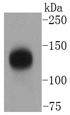 Anti-TACC3 Antibody (3B27)