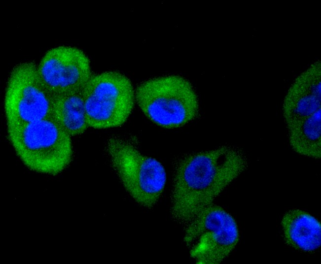 Anti-TACC3 Antibody (3B27)