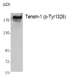 Anti-Phospho-Tensin-1 (Tyr1326) Polyclonal Antibody