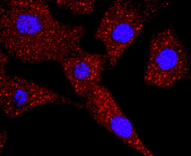 Anti-TK1 Antibody (6W861)