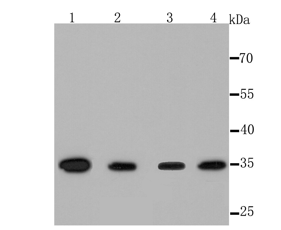 Anti-TYMS Antibody (8R369)