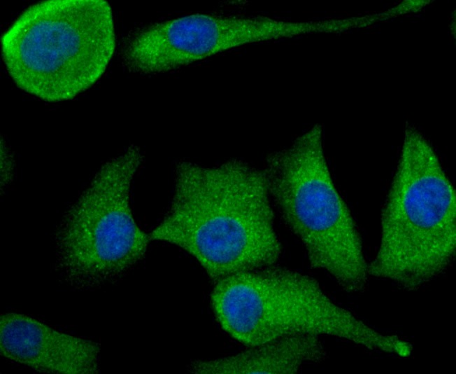 Anti-TGF alpha Antibody (1A764)