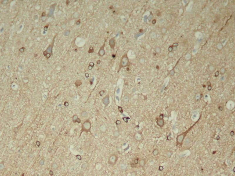 Anti-Phospho-MAPT (Ser396) Polyclonal Antibody