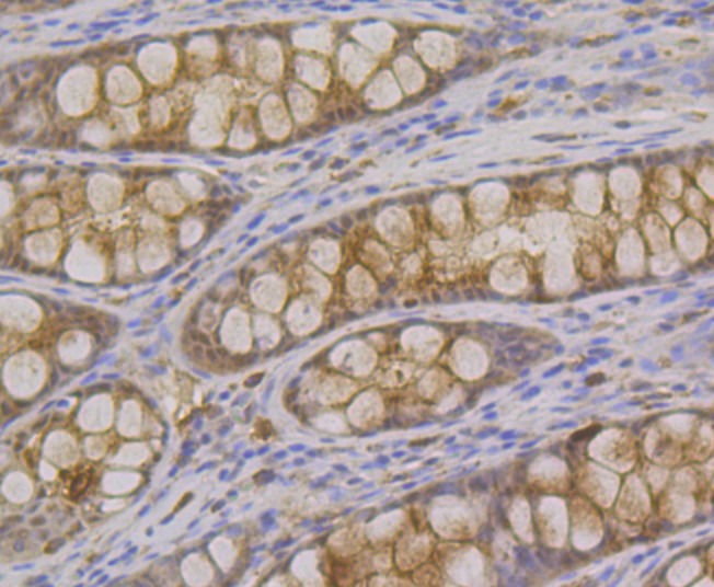 Anti-SDCBP Antibody (1Q650)